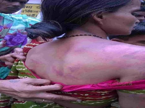 handicaped maid beaten by teacher